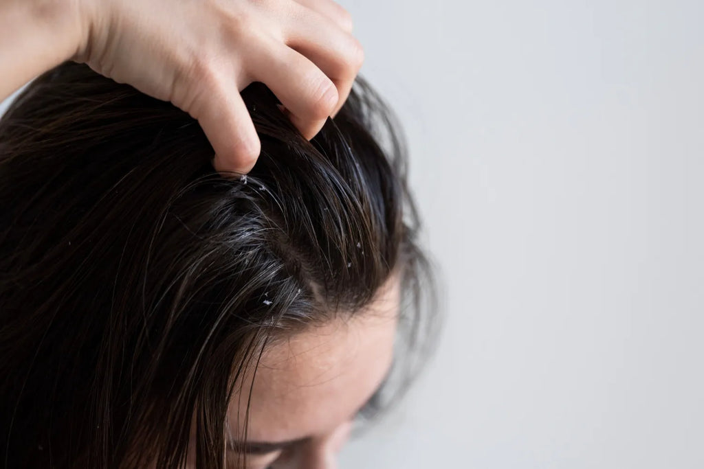 Oiling Mistakes That Can Lead to Excessive Hair Fall / Hair Damage