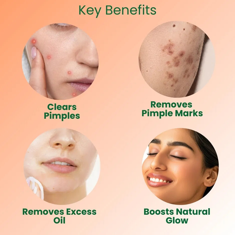 Anti Pimple Cream to Remove Pimple