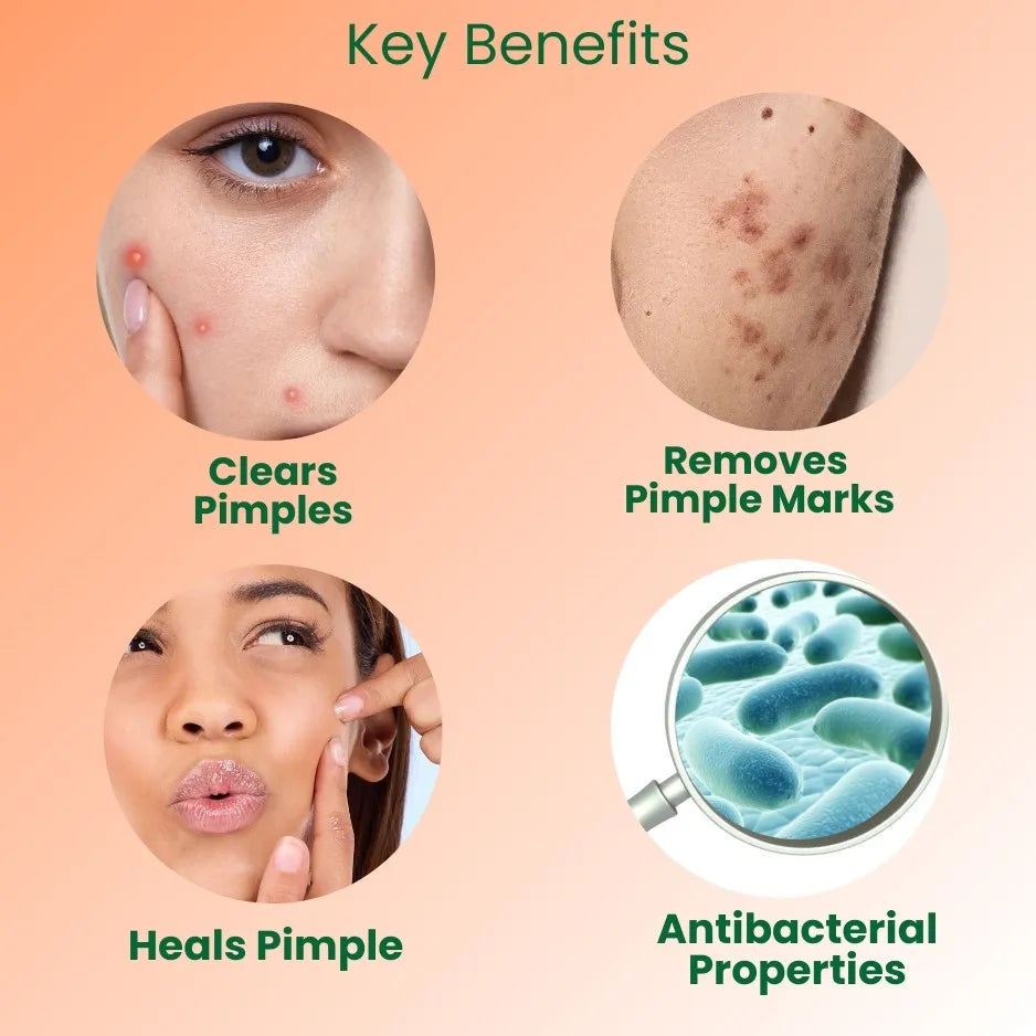 Anti Pimple Cream Online