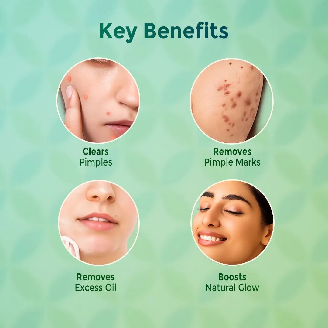 Anti Pimple Combo | Anti Acne Combo | Removes pimples/acne & its marks
