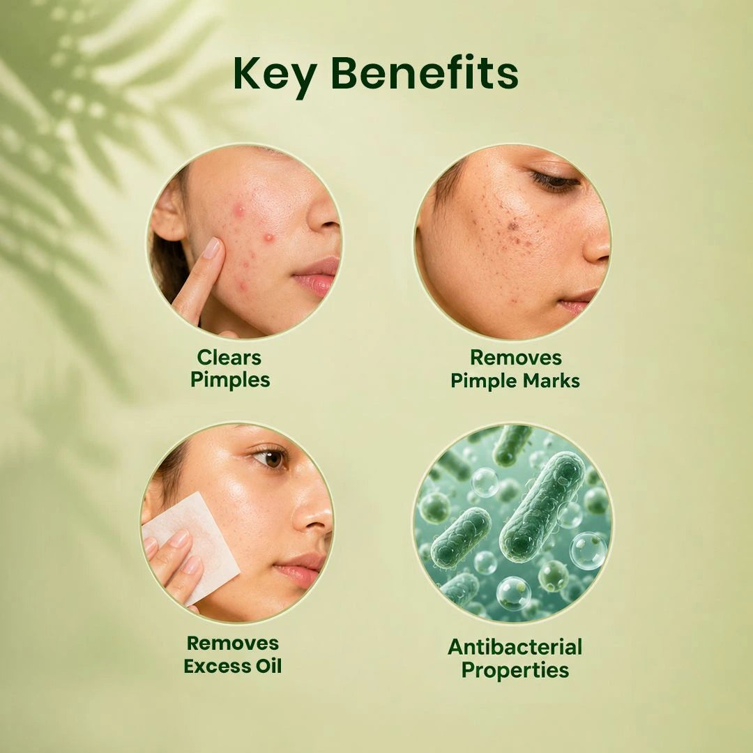 Anti pimple | Anti Acne powder - Help reduce pimples/acne & its marks